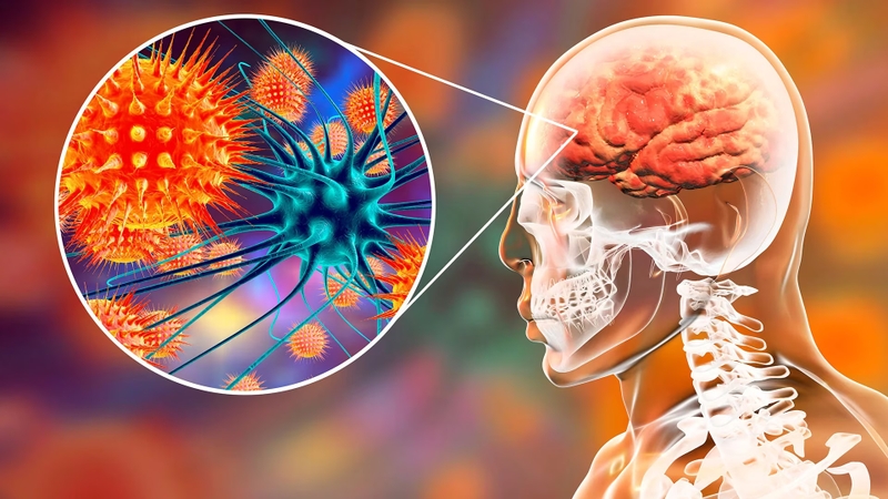 Virus Nipah Ấn Độ là gì? Dấu hiệu và biện pháp phòng ngừa dịch bệnh